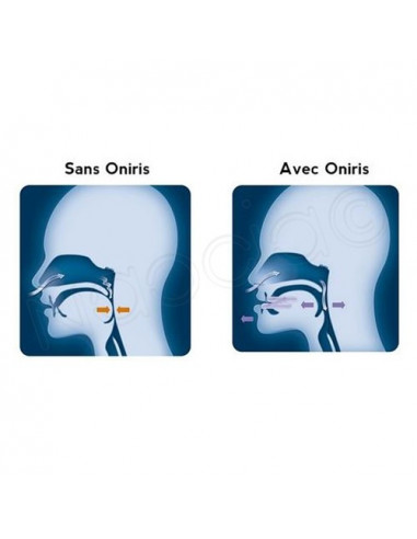 ONIRIS® : Arrêter de ronfler avec une solution anti-ronflement